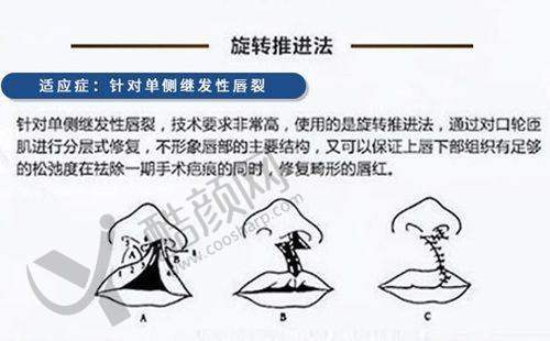 口腔CT检查价格优