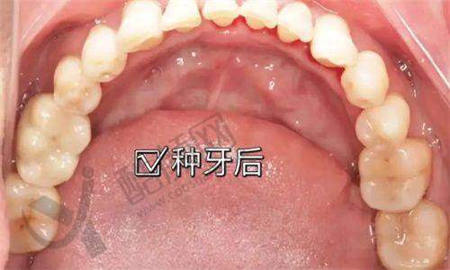 刘岩怎么预约？