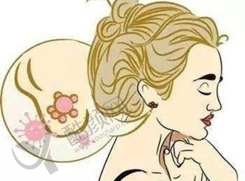 乳房整形项目