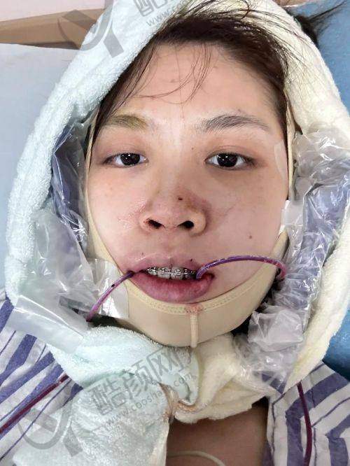 张福胤怎么预约？