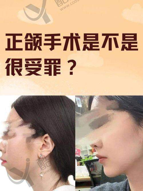 张福胤涎腺肿 瘤治疗实例
