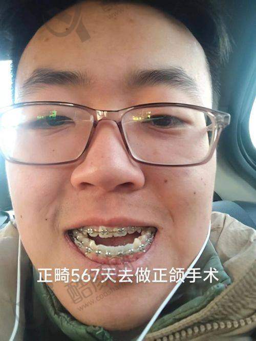 张福胤擅长做的项目：涎腺肿 瘤治疗水平怎么样可靠吗？