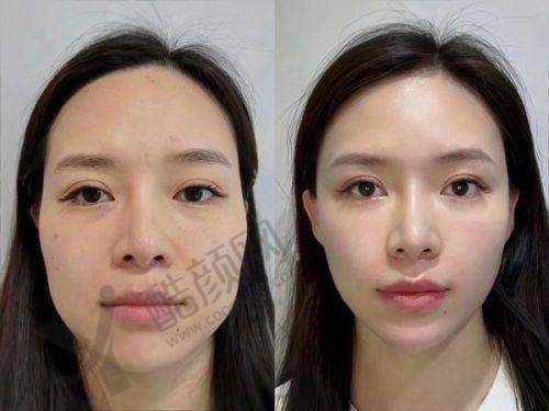 英伦大提升成效保持时长及影响因素