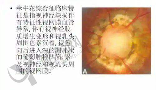 宁夏西门桥眼科医生介绍