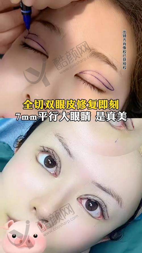 王太玲怎么预约？