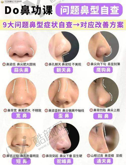 卢元刚医生简介