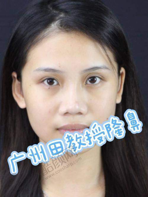 卢元刚医生口碑评价