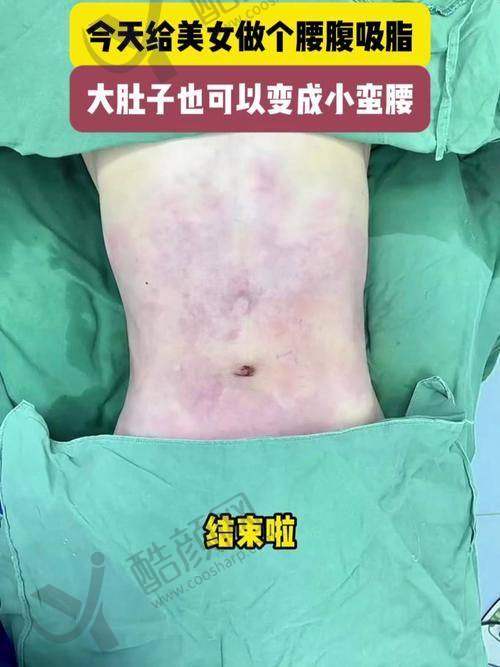 成都艾米丽医疗美容的地址与路线