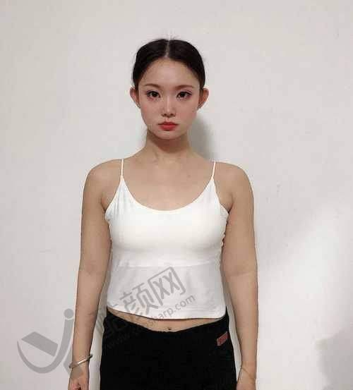 成都艾米丽医疗美容腰部吸脂技术优势