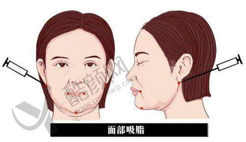 二、西安伊美尔医疗美容门诊部正规吗？来看看医院资质：