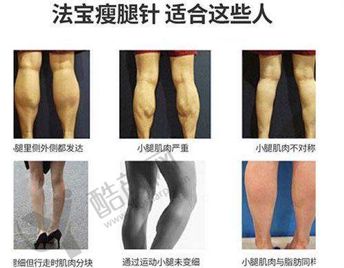 八、郑州市第二人民医院整形美容科真实的顾客评价如下：