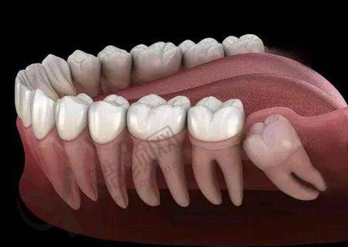 沈阳国睿口腔钴铬合金烤瓷冠800元起,透明收费与优质服务打造口腔修复新体验