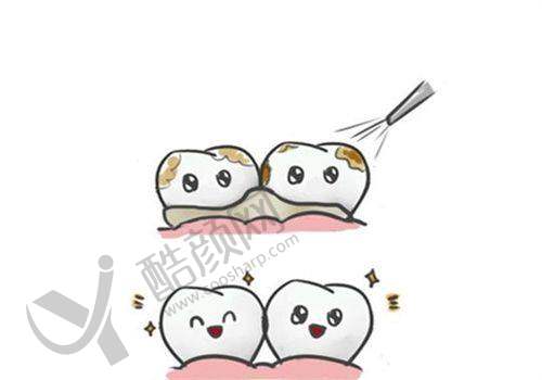 郑州德韩口腔吴豪阳医生做高难度即刻种植价格 9800 元起,亲骨技术缩短恢复时间