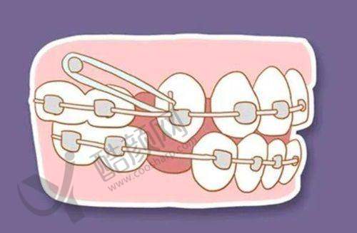 沈阳国睿口腔喷砂洗牙项目优势