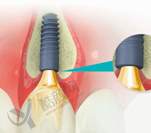 沈阳国睿口腔喷砂洗牙相关医生介绍