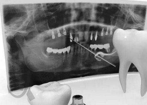 沈阳国睿口腔预约与联系