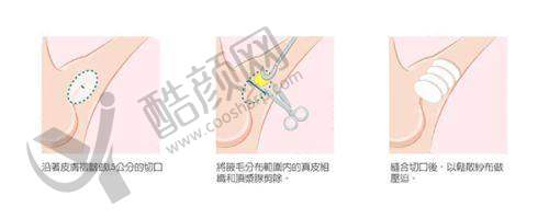 四、西安伊美尔医疗美容门诊部实例