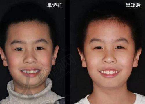 上海鼎植汪园怎么预约？