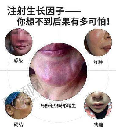 郭鑫取生长因子费用：价格实惠，性价比高
