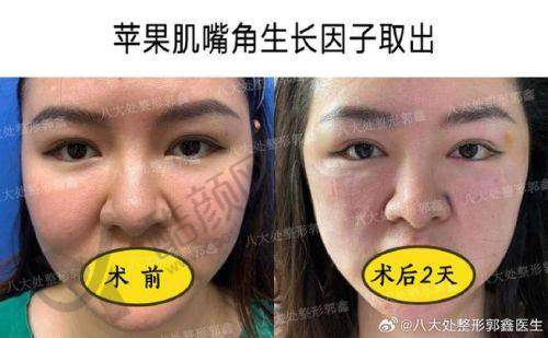 郭鑫医生简介：专精靠谱，经验多