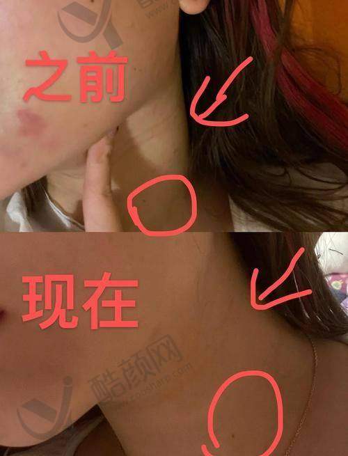 北京美莱医疗美容医院陈敏医生介绍