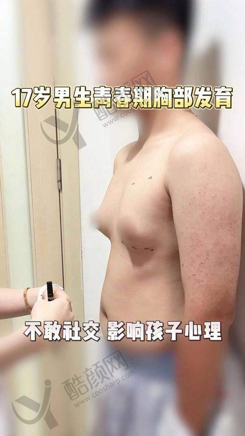 内分泌科：揪出激素失衡的“元凶”