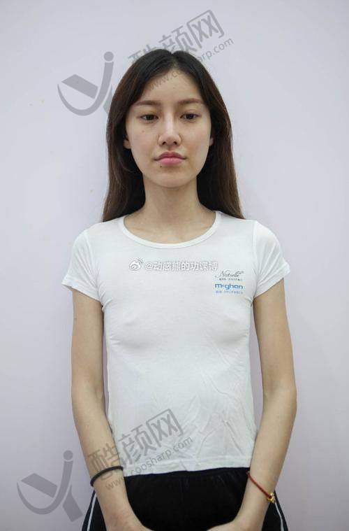 北京美莱医疗美容医院的其他优点