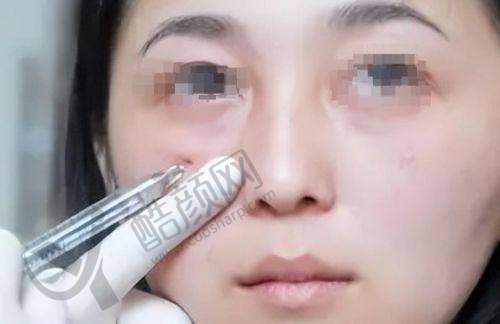 杭州周书逸医生的美学定制优势