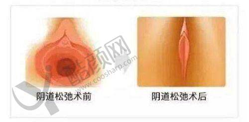 青岛博士医疗美容医院开展的项目
