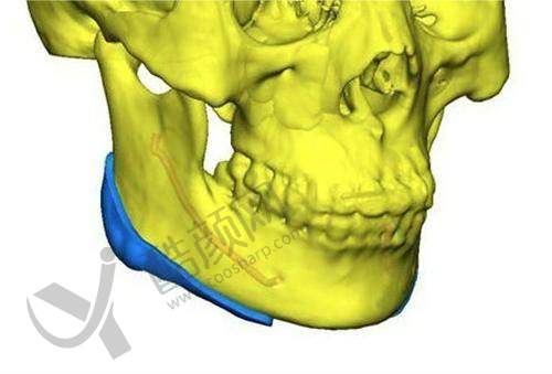 西安高一生医疗美容医院优势