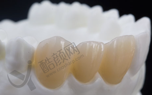 从寿命角度看瑞士种植牙的优势