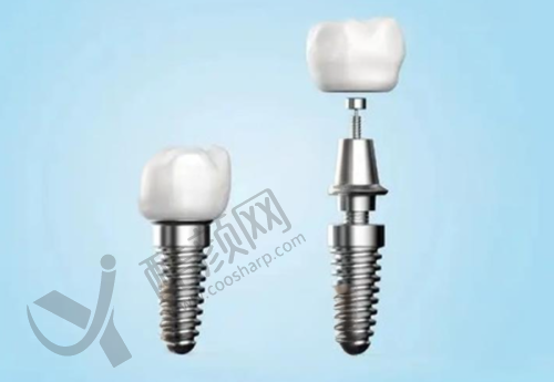 深度洁牙助力牙龈贴合牙齿