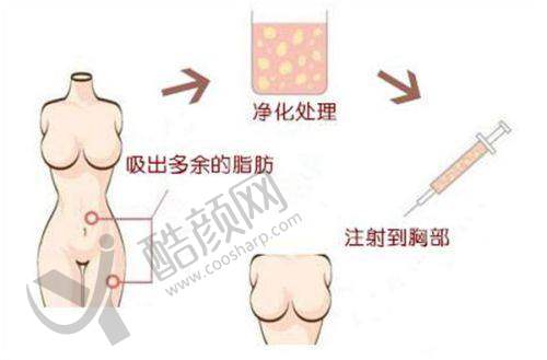 杭州周书逸医生：技术特点突出