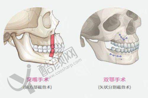 青岛博士医学整形美容医院的价格情况