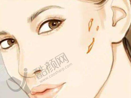 深圳和美医疗美容整形医院的价格透明