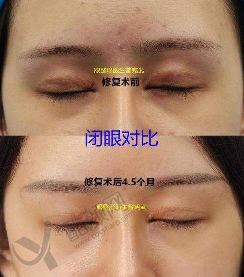 杨小顺医生——郑州顺柳姮美医疗美容
