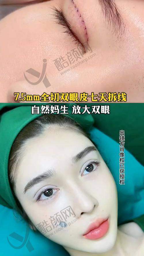 杨胜发医生——郑州缔莱美整形