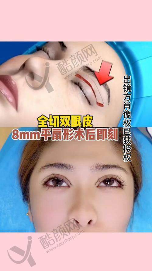 上海杜园园医生简介