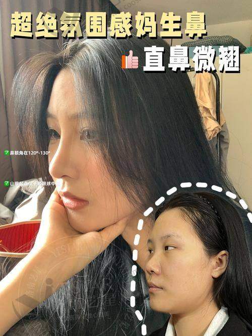 冯雁平医生:自然翘鼻风的塑造者