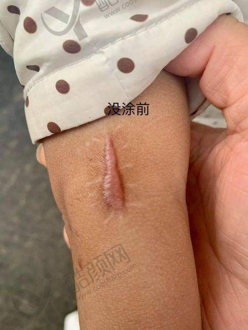 新疆黎美整形美容：老牌机构值得信赖