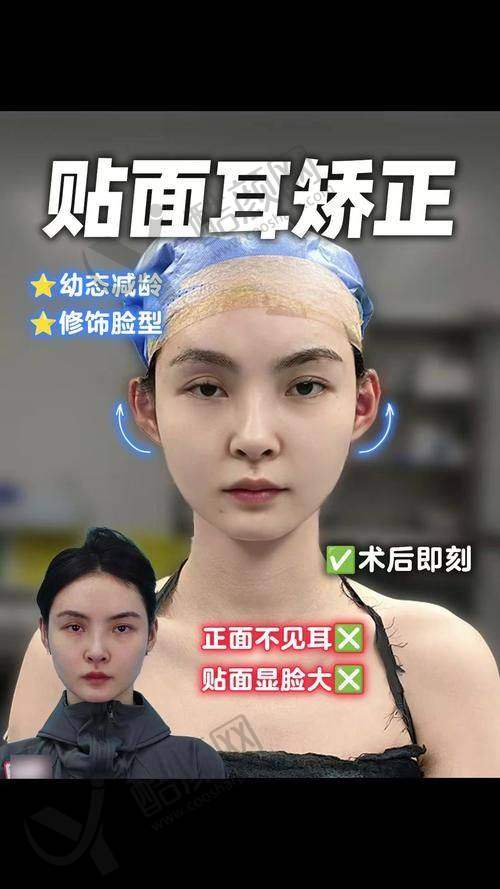 毋巨龙院长擅长的耳朵整形项目