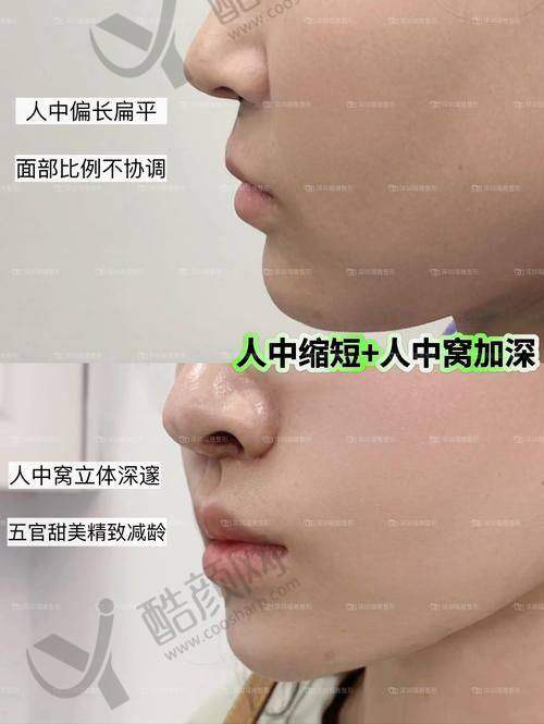 谭拯医生简介