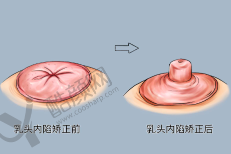 重庆军科整形VS华美整形:服务体验哪家好