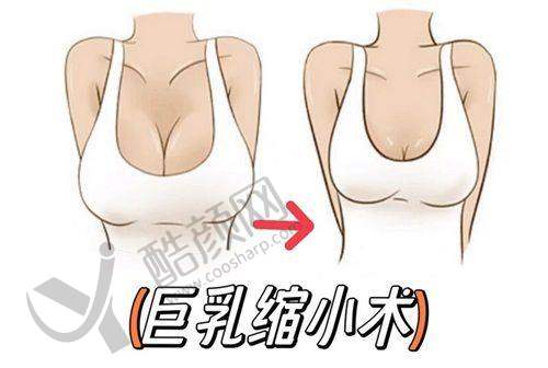 东莞爱思特魏鑫铭在哪家医院