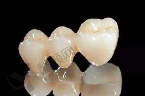 上海雅悦口腔门诊部的价格优势