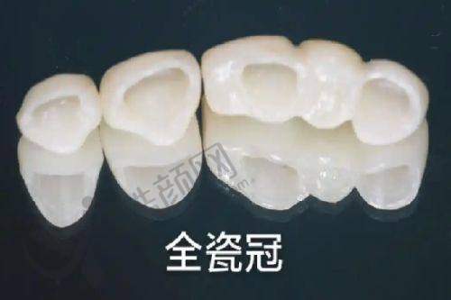 上海雅悦口腔门诊部的技术优势