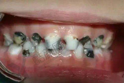 上海雅悦口腔门诊部:亲民价格特别实惠