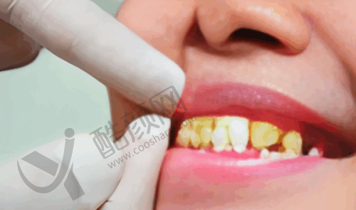 五、西安诺贝尔口腔门诊部怎么预约: