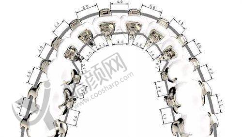 张竟铭牙齿矫正水平怎么样可靠吗?