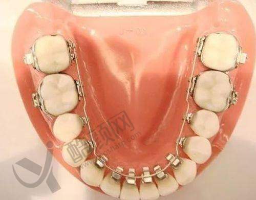 揭阳诺贝尔口腔医院简介、项目及收费全揭秘,数字化技术领先,市民口碑超棒